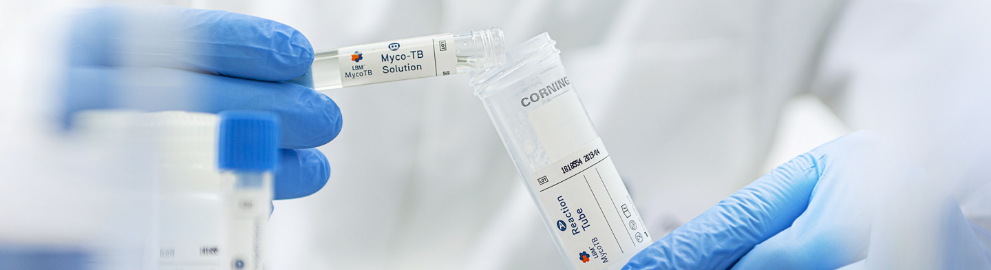 MycoTB™