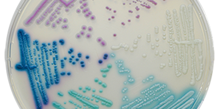 Chromogene Nährmedien - Fertigplatten