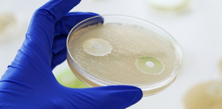 MASTDISCS® mit Antimykotikum
