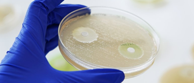 MASTDISCS® mit Antimykotikum