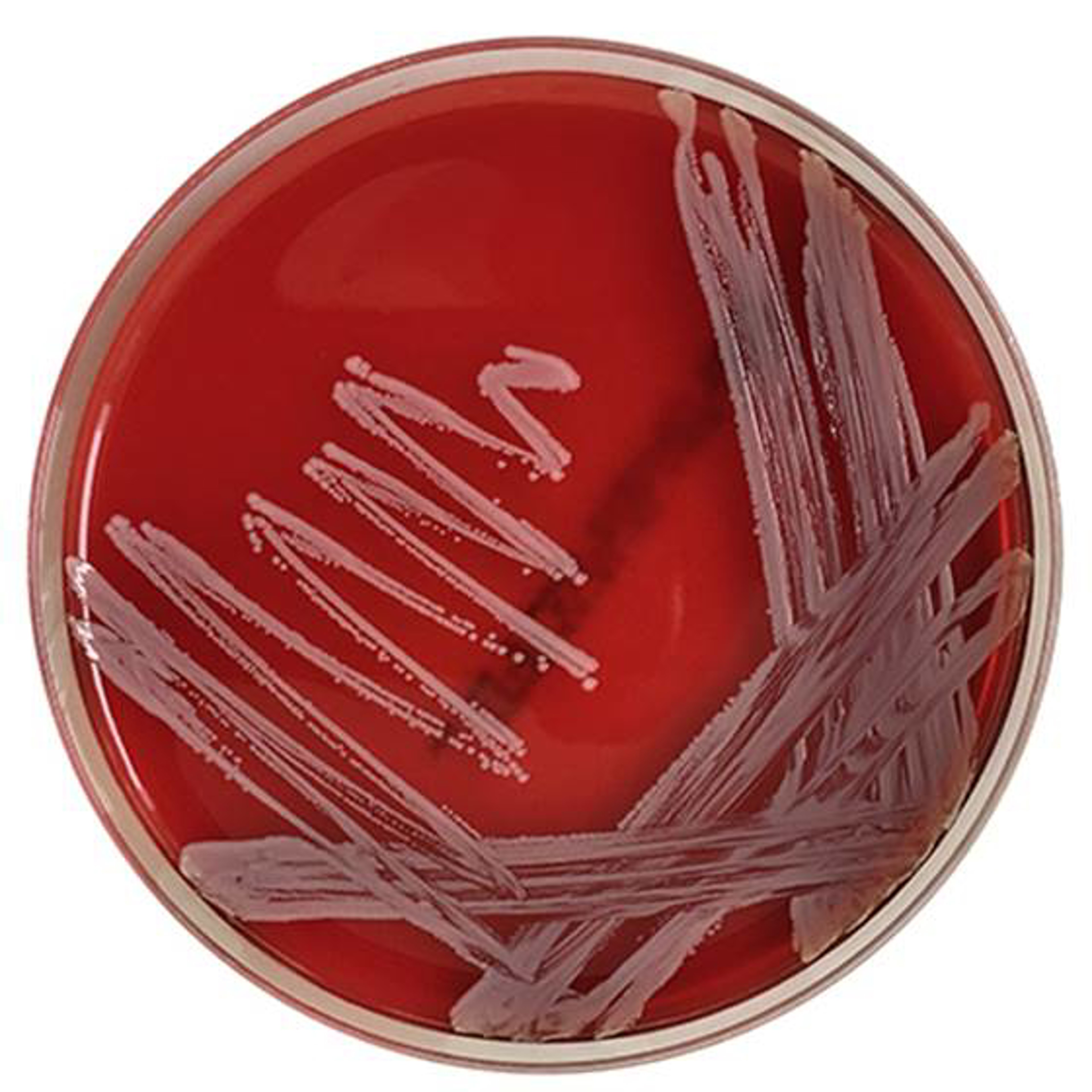 Columbia-Agar mit 5 % Schafblut Fertigplatten