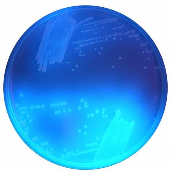 CD122