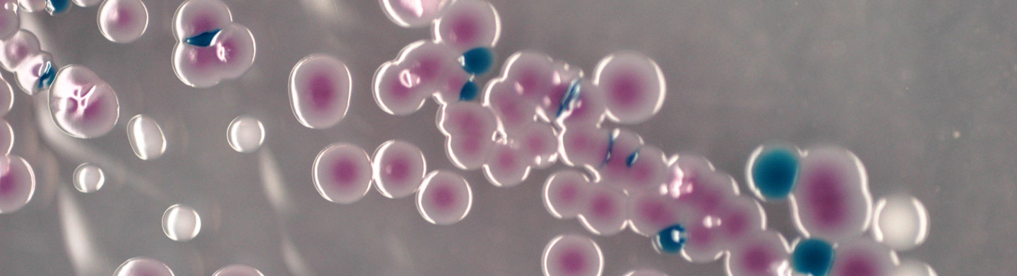 Chromogene Nährmedien - Bouillons