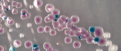 Chromogene Nährmedien - Bouillons