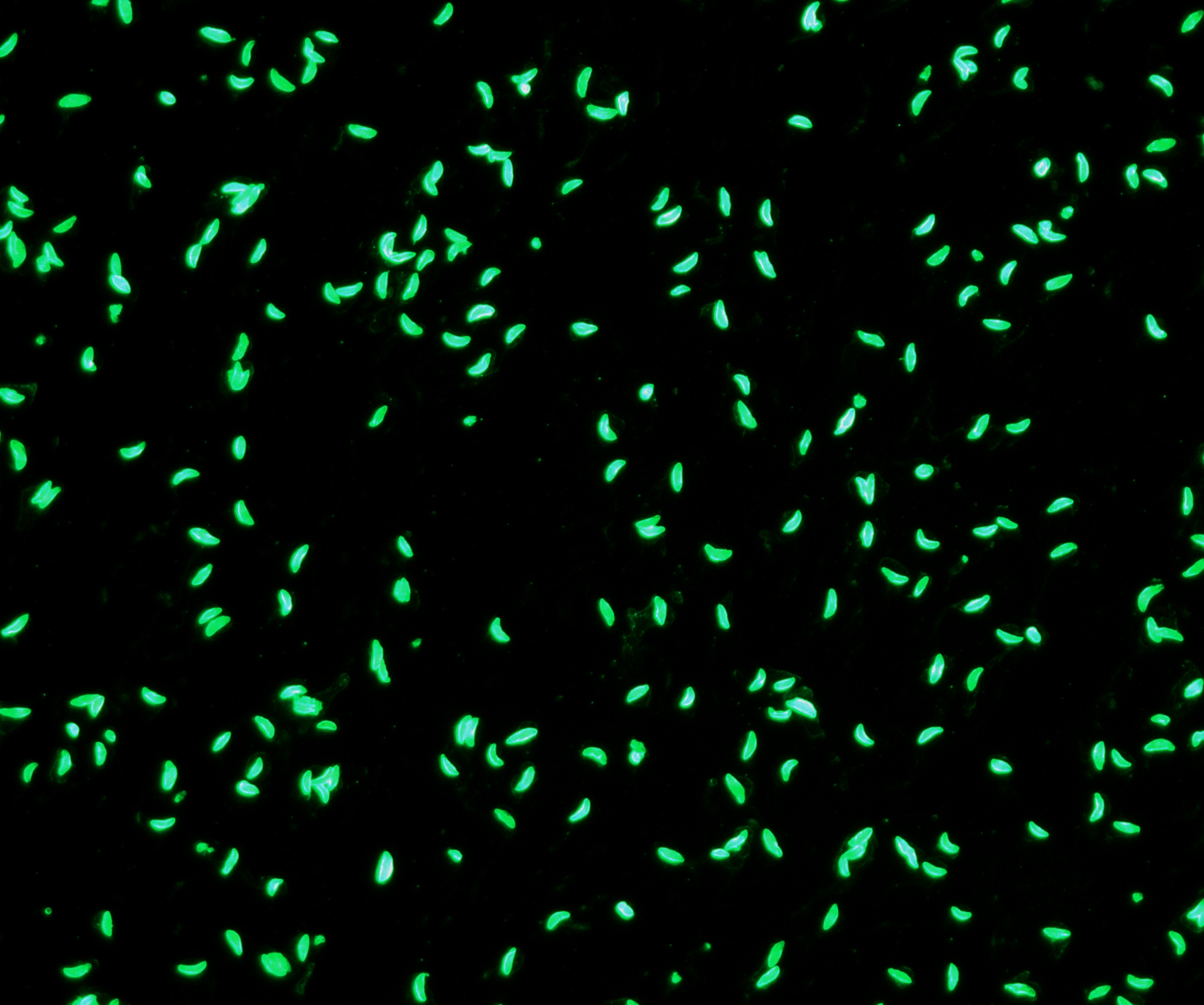 Immunfluoreszenztest
