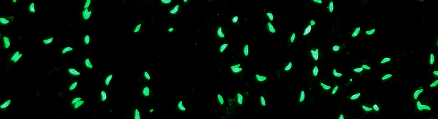 Immunfluoreszenztest