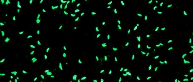 Immunfluoreszenztest