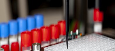 UniVerse-Bild Pipette.jpg