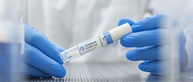 hDNA freie Tupfer