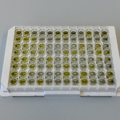agglutinationstest.jpg