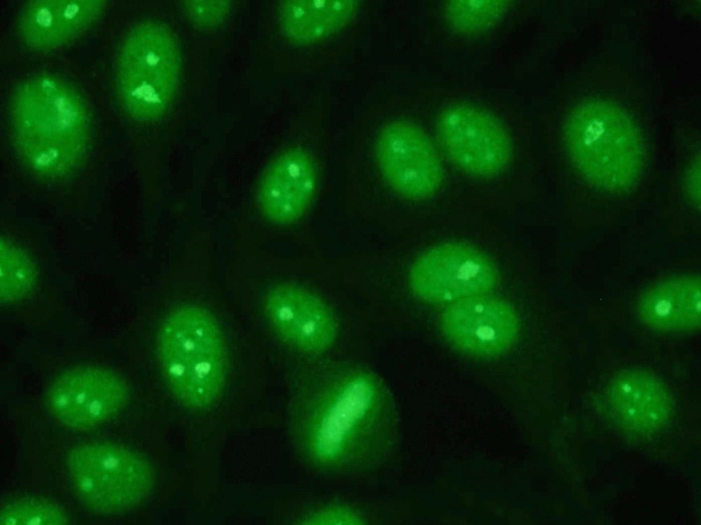 Immunfluoreszenztest