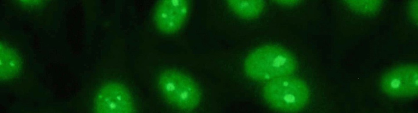 Immunfluoreszenztest
