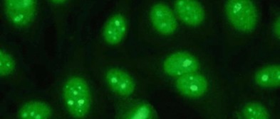 Immunfluoreszenztest