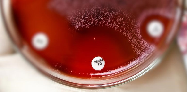 ESBL, AmpC und Carbapenemasen Detektion