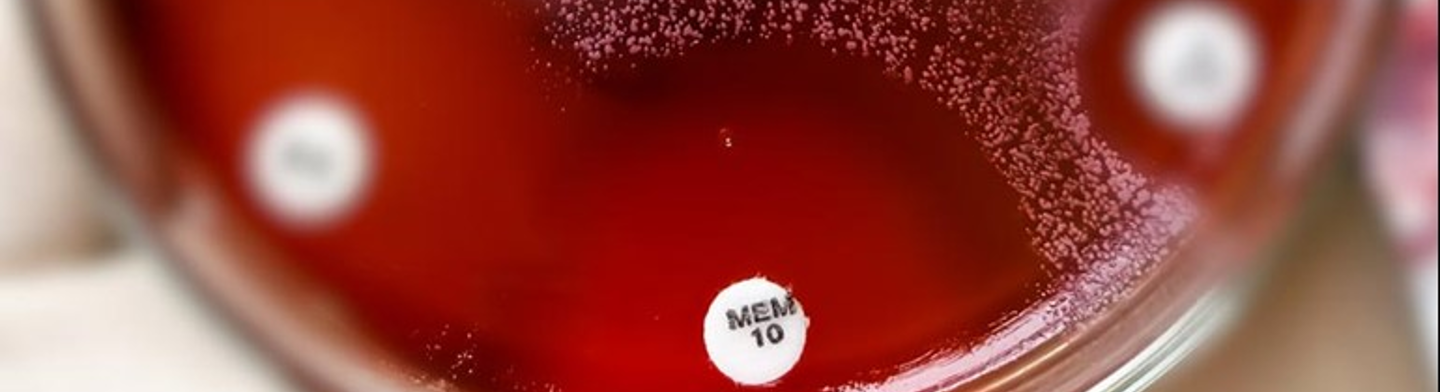 ESBL, AmpC und Carbapenemasen Detektion