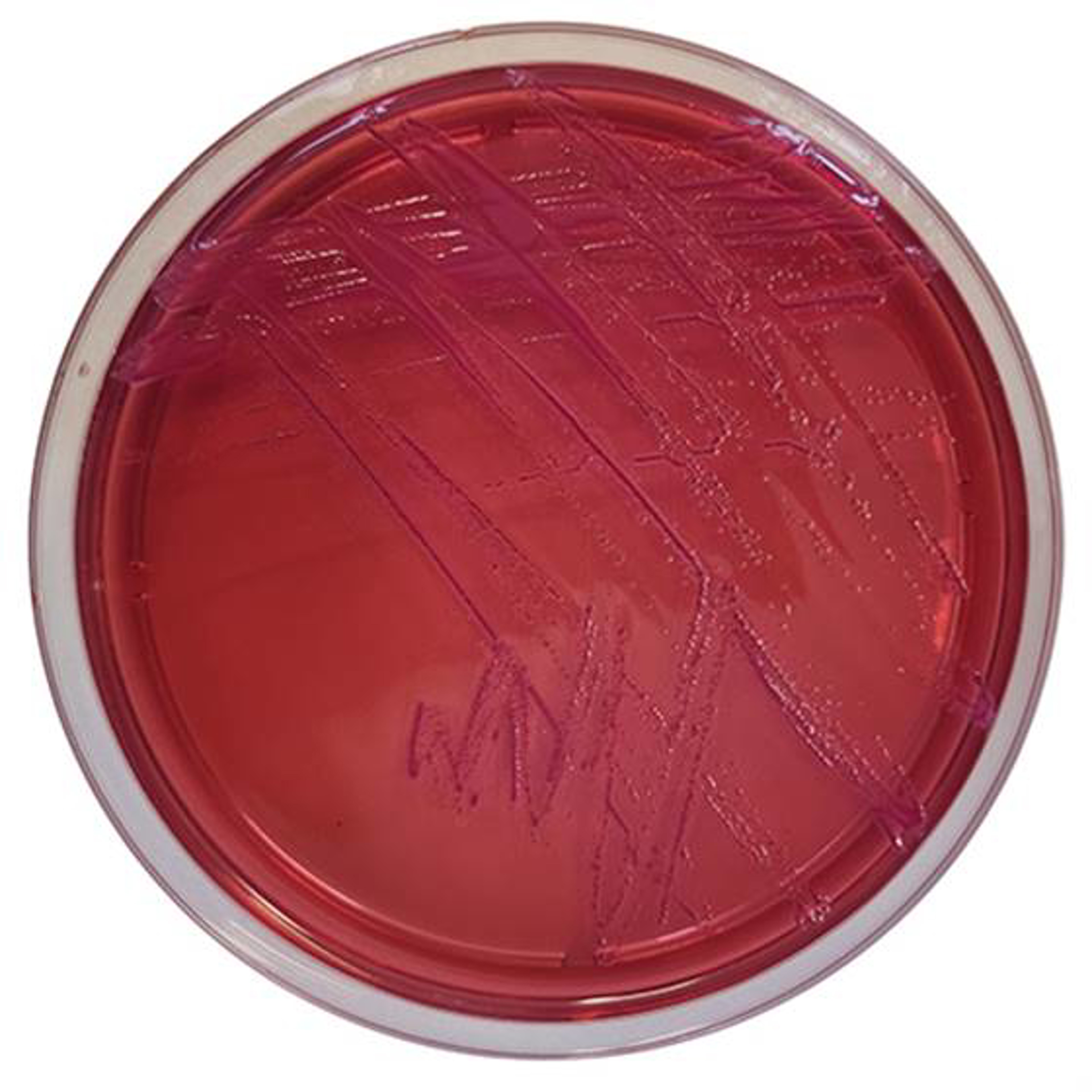 Yersinia CIN Agar Fertigplatten