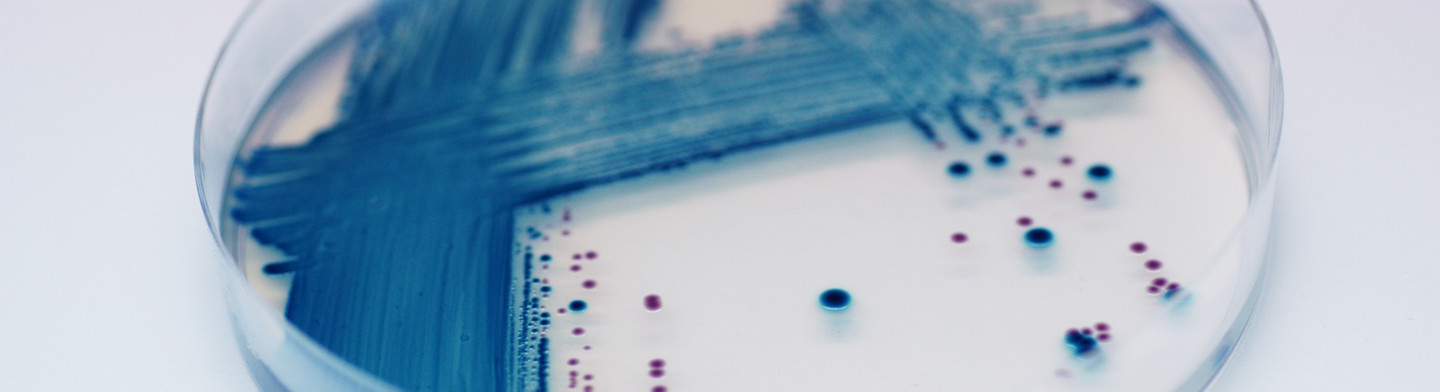 Chromogene Nährmedien - Trockennährmedien