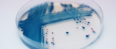 Chromogene Nährmedien - Trockennährmedien