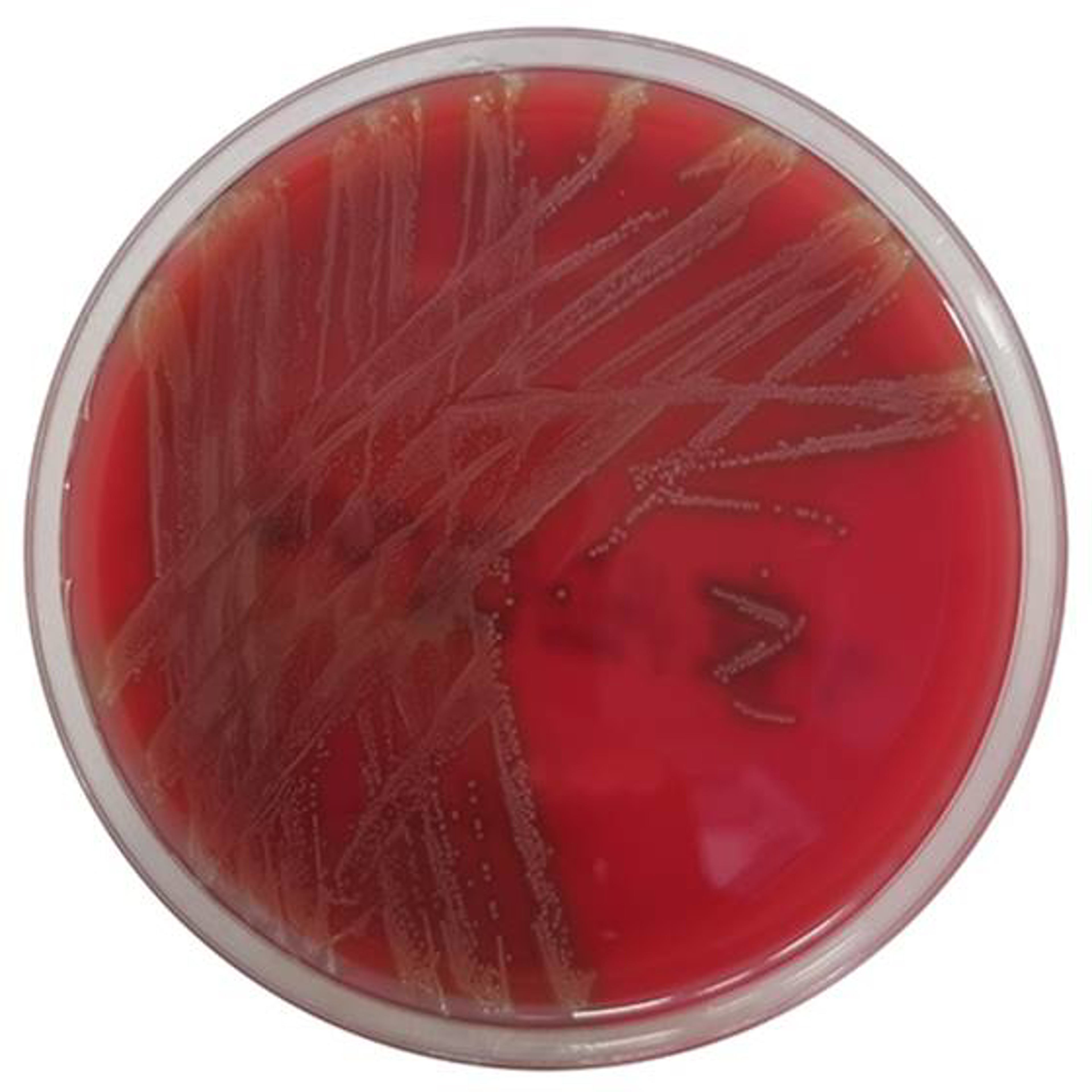 Columbia-CNA-Agar mit 5 % Schafblut Fertigplatten