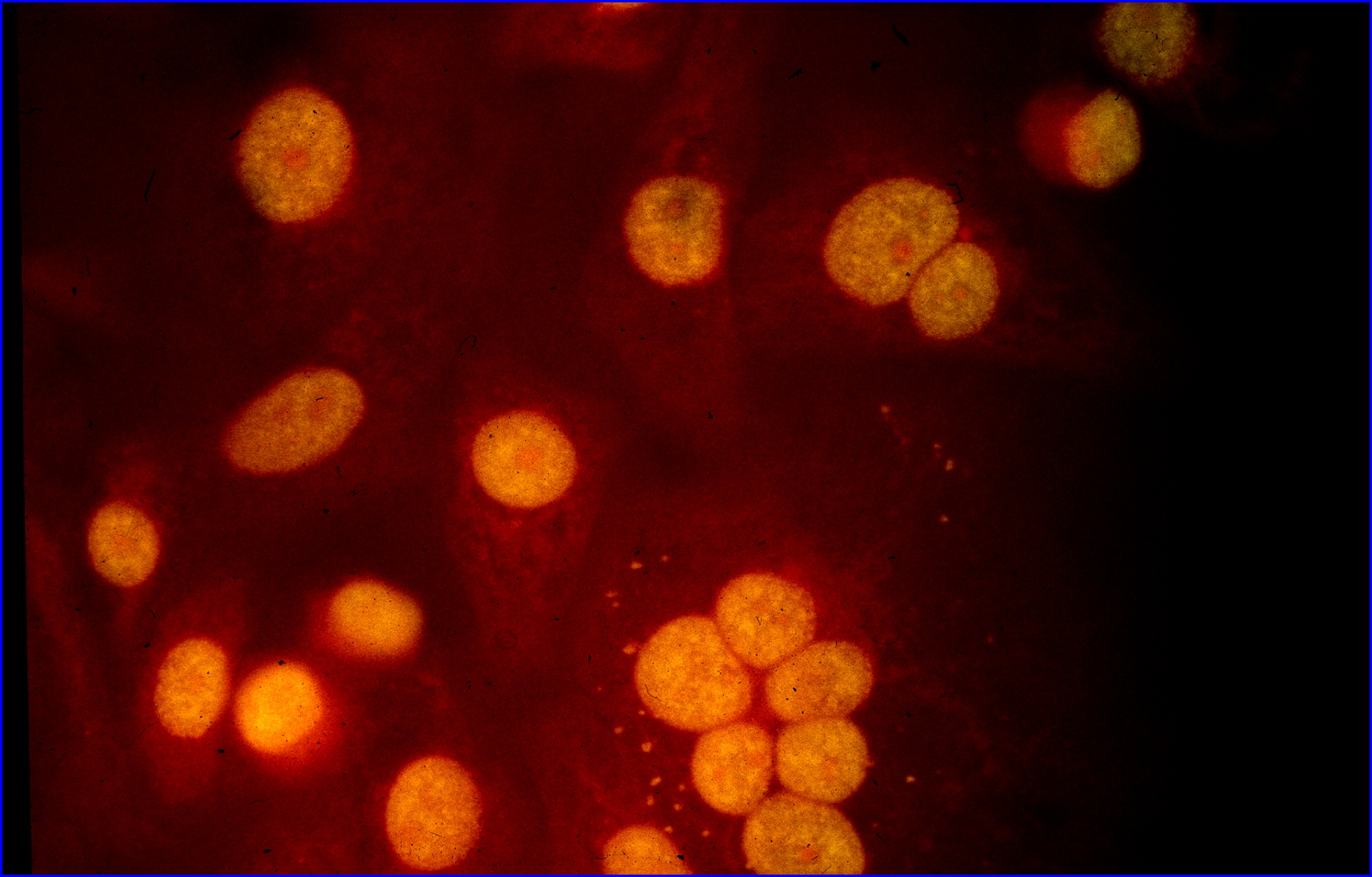 Autoimmundiagnostik