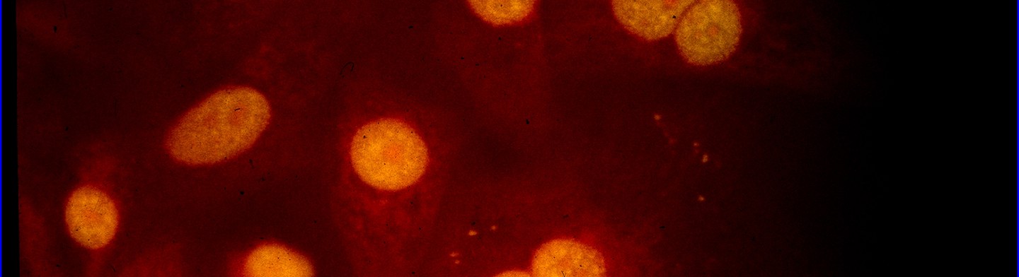 Autoimmundiagnostik