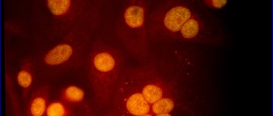 Autoimmundiagnostik