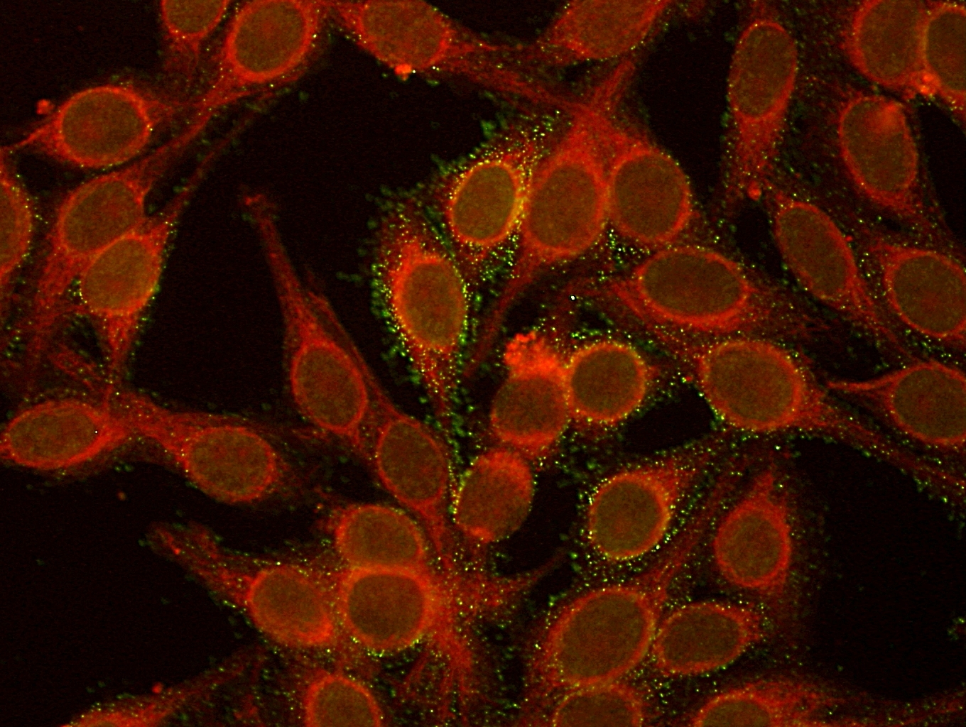 Autoimmundiagnostik