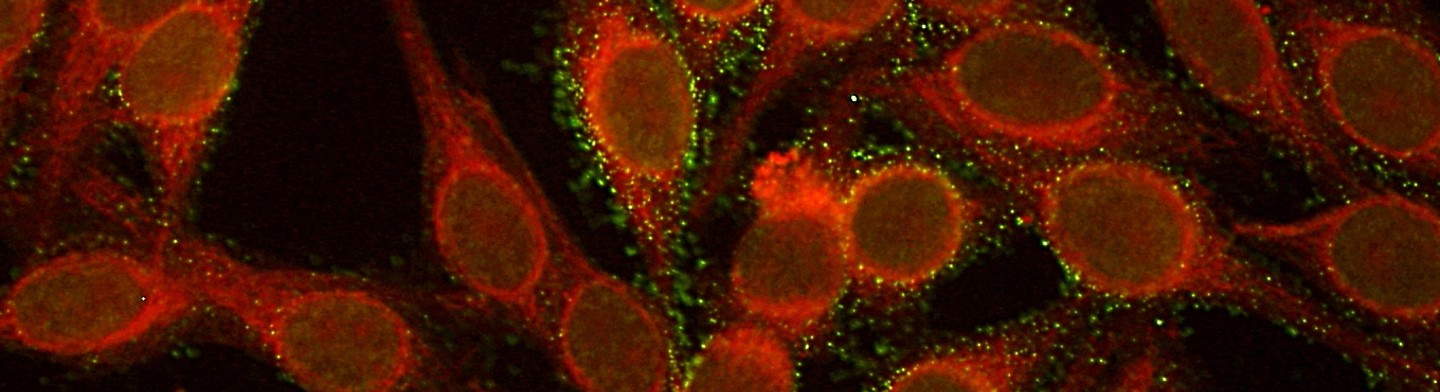 Autoimmundiagnostik