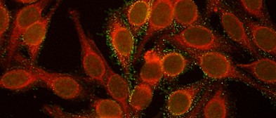 Autoimmundiagnostik