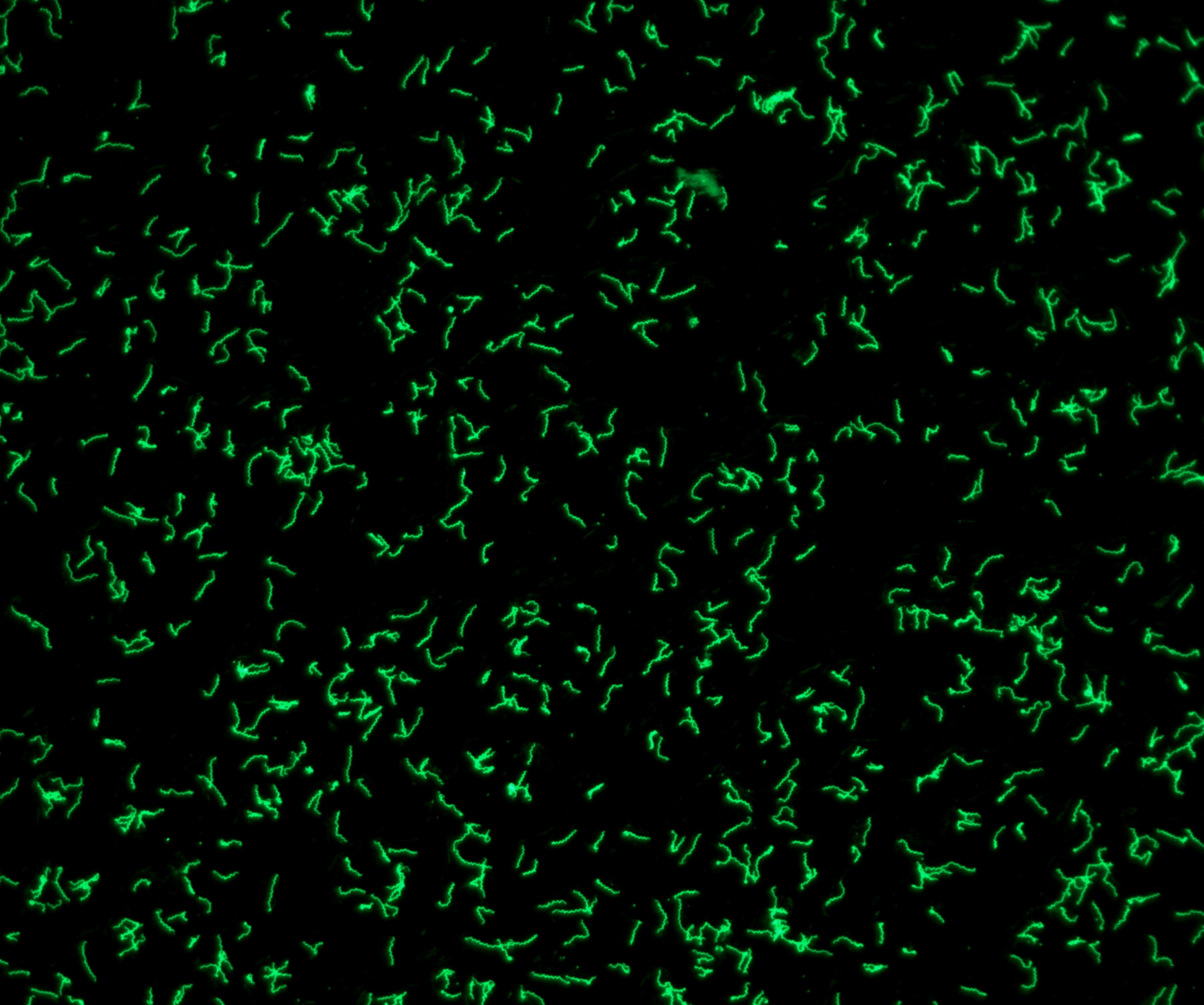 Immunfluoreszenztest.jpg