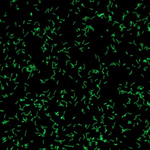 Immunfluoreszenztest.jpg