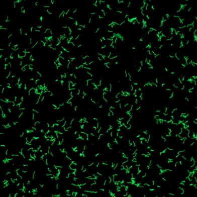 Immunfluoreszenztest.jpg