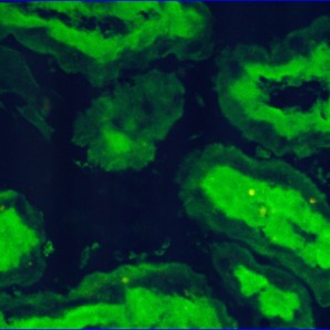 Immunfluoreszenztest.jpg